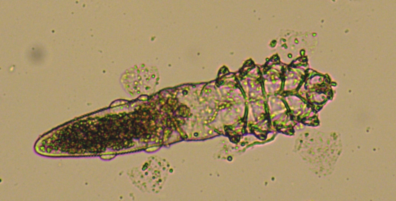 Demodex Mites: What They Are and How to Manage Them Naturally
