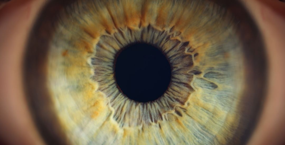 Signs Your Meibomian Glands Are Blocked (and What to Do at Home)